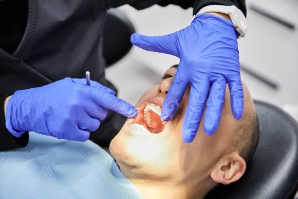 Best Emergency Treatment for Toothache in Colfax, LA