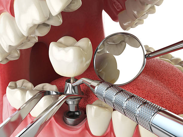 Best 24-Hour Emergency Dentist in Colfax, LA
